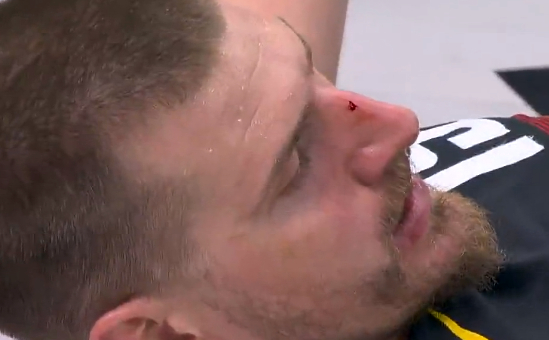 约基奇鼻梁被撞出血戈登怒吼未获判罚引争议